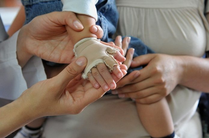 niña-quemada-piura-referencial