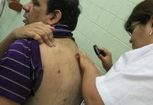 Alta radiación solar es la principal causa del cáncer a la piel