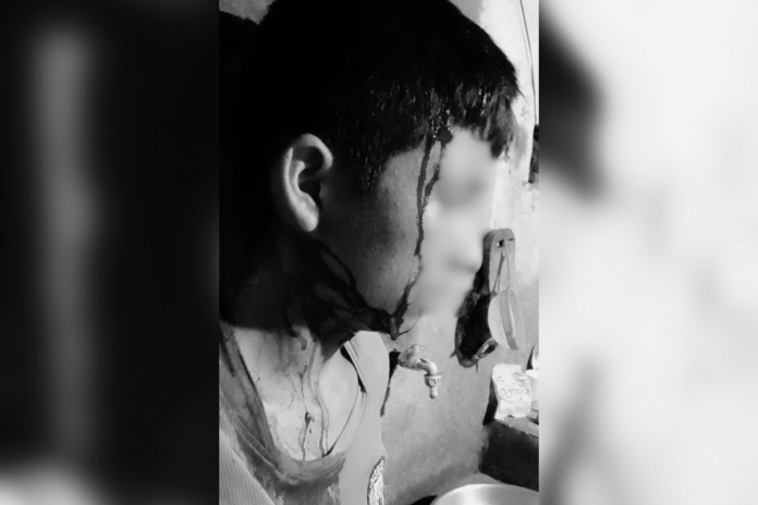 Indignación en Paimas Fiscalía deja libre a sujeto acusado de agredir a su pareja y dejar inconsciente a su hijo Indignación en Paimas: Fiscalía deja libre a sujeto acusado de agredir a su pareja y dejar inconsciente a su hijo